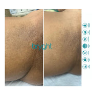 BRYGHT INTIMATE 2 STEP BLEACHING KIT