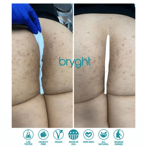 BRYGHT INTIMATE 2 STEP BLEACHING KIT