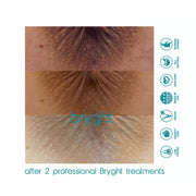 BRYGHT INTIMATE 2 STEP BLEACHING KIT