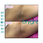 BRYGHT INTIMATE 2 STEP BLEACHING KIT