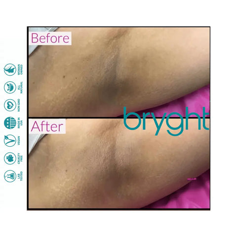 BRYGHT INTIMATE 2 STEP BLEACHING KIT