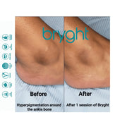 BRYGHT INTIMATE 2 STEP BLEACHING KIT