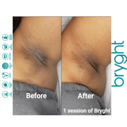 BRYGHT INTIMATE 2 STEP BLEACHING KIT