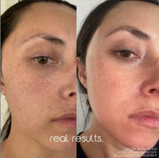 BRYGHT INTIMATE 2 STEP BLEACHING KIT